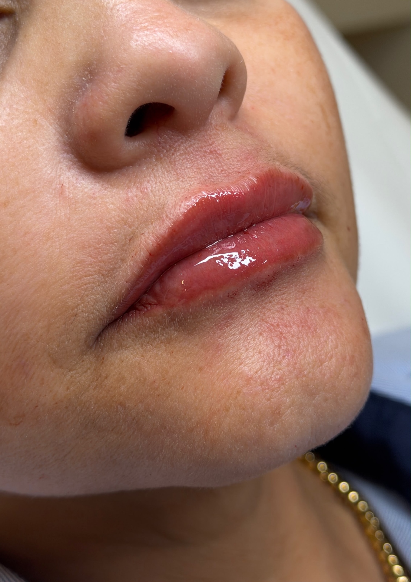 Hidratação e volume labial
