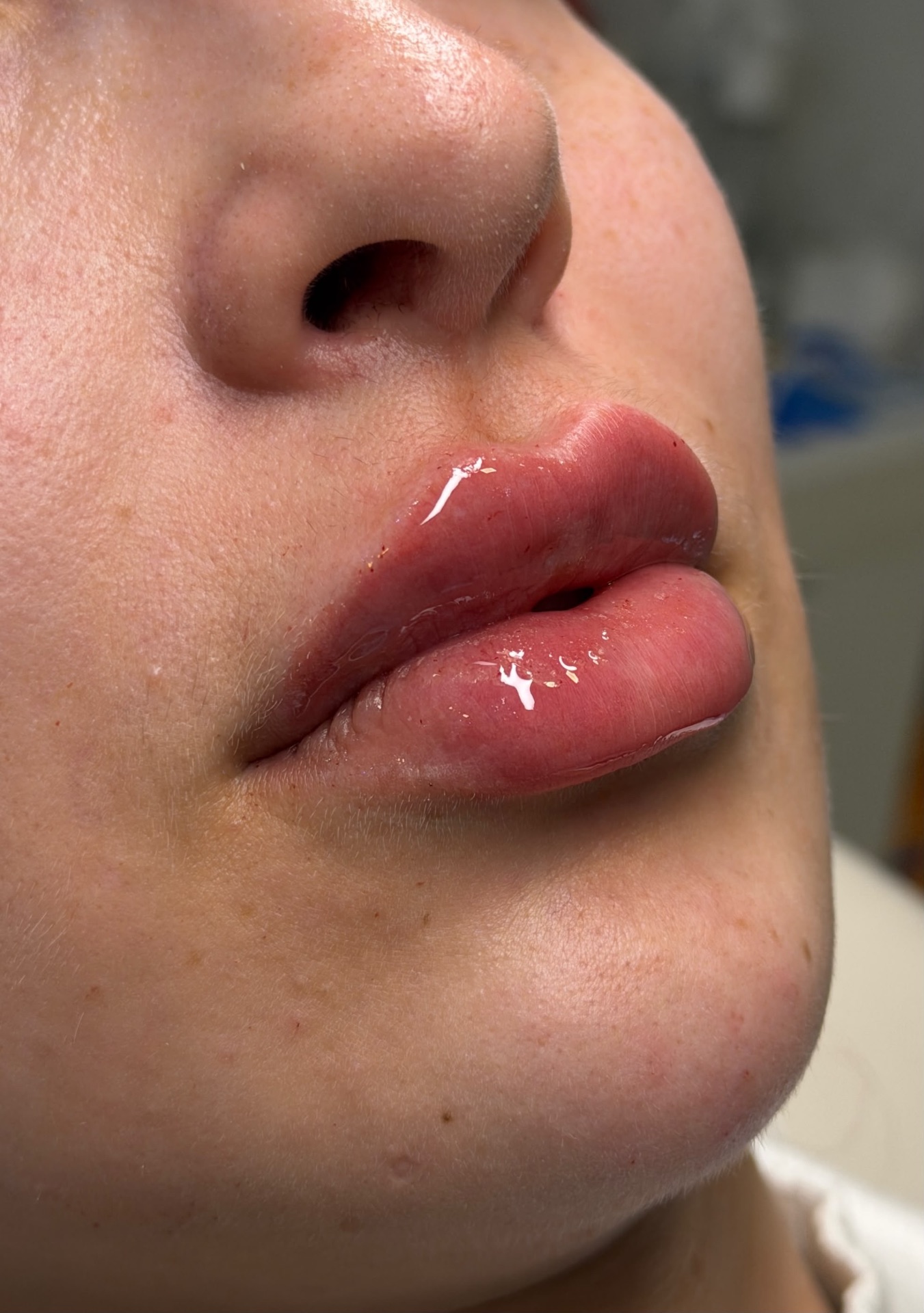 Contorno labial · desenho definido